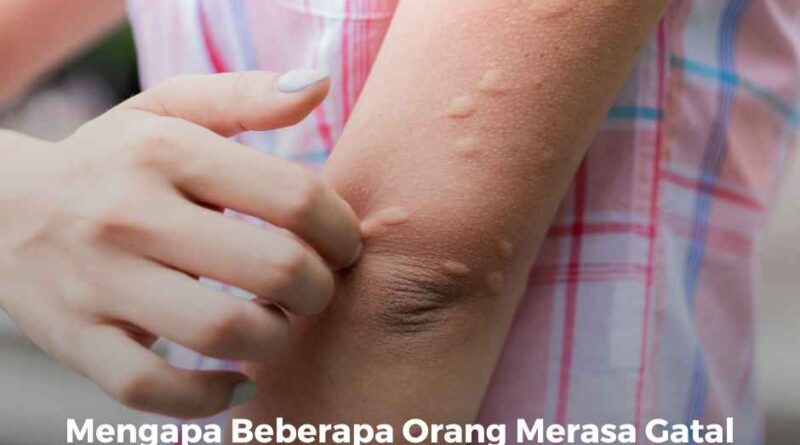 Mengapa Beberapa Orang Merasa Gatal Berlebihan Setelah Gigitan Nyamuk?